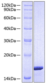 Recombinant Human Mature GDNF Protein