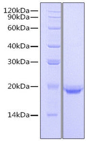 Recombinant Human IL-17F Protein