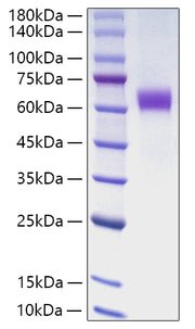 Recombinant Human Jagged1/JAG1/CD339 Protein