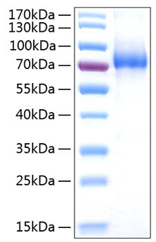 Recombinant Human IL-7RA/CD127 Protein