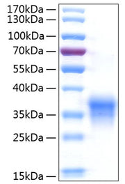 Recombinant Human IFN-lambda 1/IL-29 Protein