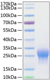 Recombinant Human ALK-1/ACVRL1 Protein