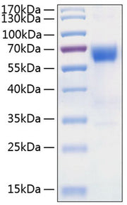 Recombinant Human TNFRSF10D/DcR2/TRAIL-R4/CD264 Protein