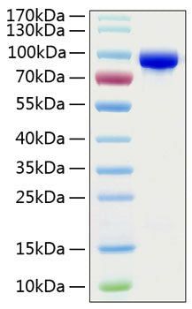 Recombinant Human Transferrin/TF Protein