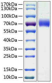 Recombinant Human Kininogen-1/KNG1 Protein