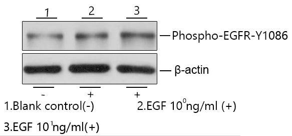 Recombinant Human EGF Protein