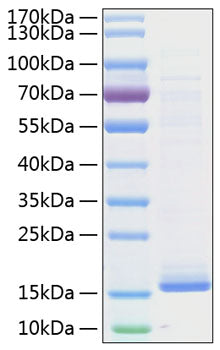 Recombinant Human Cystatin-D/CST5 Protein