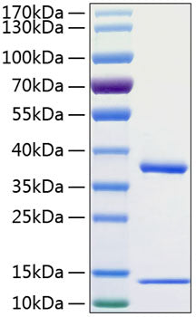Recombinant Human FcRn/FCGRT&B2M Protein