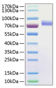 Recombinant Human Fc-gamma RIII alpha/FCGR3A /CD16a Protein