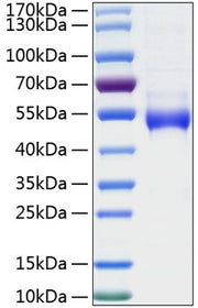 Recombinant Human Galectin-9/LGALS9 Protein