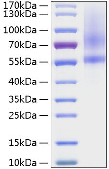 Recombinant Human Testican-1/SPOCK1 Protein