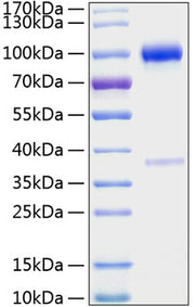 Recombinant Mouse TNFRSF11B/Osteoprotegerin Protein