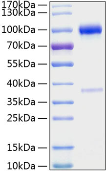 Recombinant Mouse TNFRSF11B/Osteoprotegerin Protein