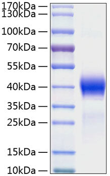 Recombinant Mouse Dkk-1 Protein