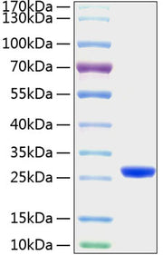 Recombinant Mouse Lipocalin-2/NGAL/LCN2 Protein