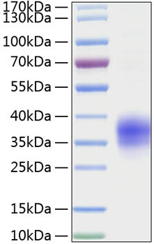 Recombinant Mouse TNFRSF1A/TNF-R1/CD120a Protein
