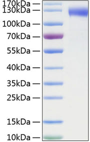 Recombinant Mouse E-selectin/SELE/CD62E Protein