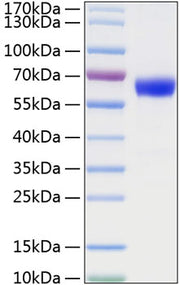 Recombinant Mouse TNFRSF1A/TNF-R1/CD120a Protein