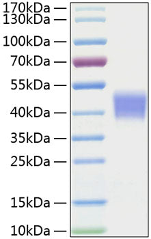 Recombinant Mouse IL-21R/CD360 Protein