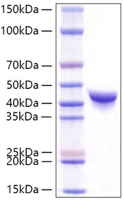 Recombinant Human DPEP1 Protein