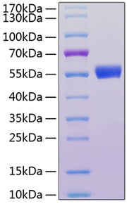Recombinant Human  IL-18 R beta/IL-1 R7/CD218b  Protein