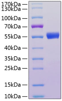 Recombinant Human  IL-18 R beta/IL-1 R7/CD218b  Protein