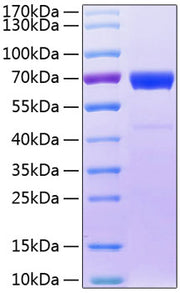 Recombinant Human IL-20RB Protein