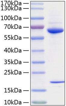 Recombinant Human PCSK9 Protein
