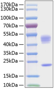 Recombinant Human IL-23/IL-12B&IL-23A Protein