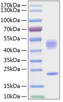 Recombinant Human IL-23/IL-12B&IL-23A Protein