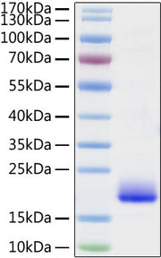 Recombinant Mouse IL-4 Protein