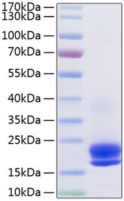 Recombinant Human VEGF-A/VEGF121 Protein