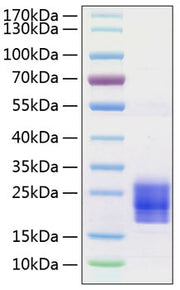 Recombinant Human/Mouse/Rat Irisin/FNDC5 Protein