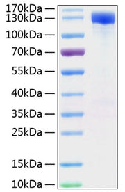 Recombinant Mouse ErbB-2/HER2/CD340 Protein