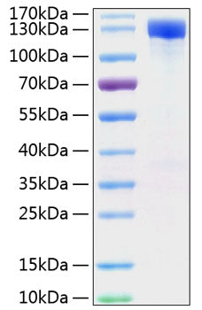 Recombinant Mouse ErbB-2/HER2/CD340 Protein
