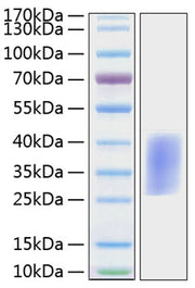 Recombinant Mouse PD-1/PDCD1/CD279 Protein