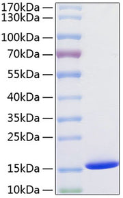 Recombinant Human Cystatin-SA/CST2 Protein