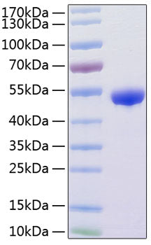 Recombinant Human Renin/REN Protein