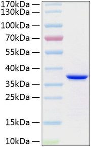Recombinant Human Annexin A5/ANXA5 Protein
