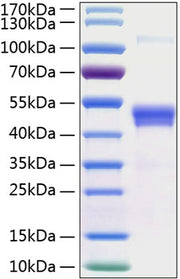 Recombinant Human TSG-14/PTX3 Protein