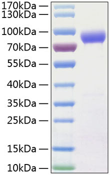 Recombinant Human IL-15RA/CD215 Protein