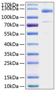 Recombinant Human Thrombospondin-1/THBS1 Protein
