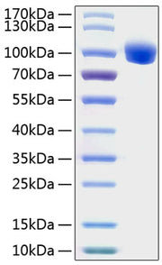 Recombinant Human ROR1 Protein