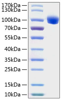 Recombinant Human ROR1 Protein