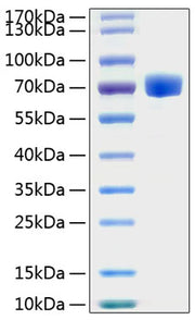 Recombinant Human EphA7/EHK-3 Protein