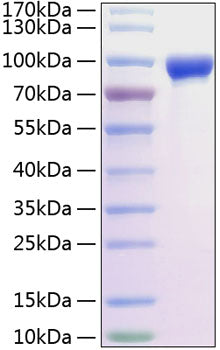 Recombinant Rat MMP-9 Protein