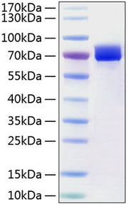 Recombinant Human Mesothelin/MSLN Protein