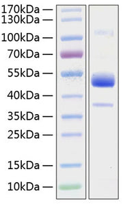 Recombinant Human BMPR-1B/ALK-6/CDw293 Protein