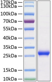 Recombinant Rat Lipocalin-2/NGAL/LCN2 Protein