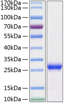 Recombinant Rat Lipocalin-2/NGAL/LCN2 Protein